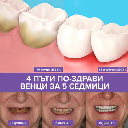 🦷Коректор на цвета на зъбите и серум за грижа за емайла